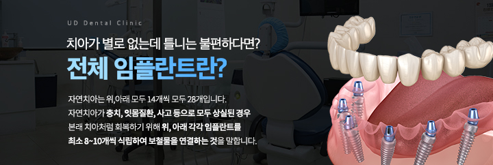 전체임플란트