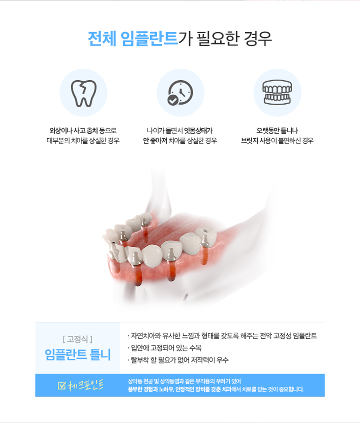 전체임플란트란