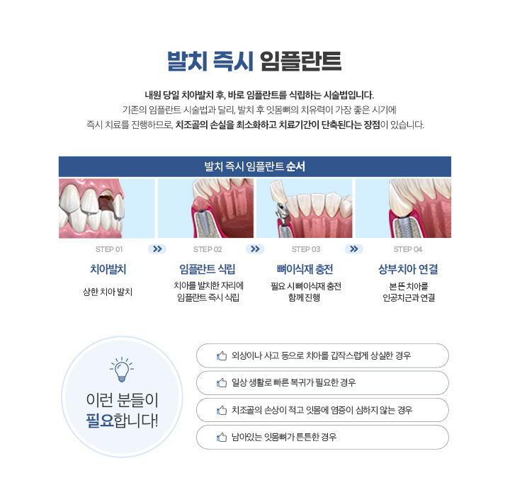 발치즉시임플란트