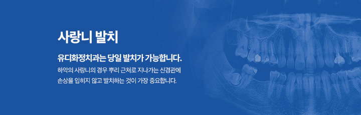 사랑니발치
