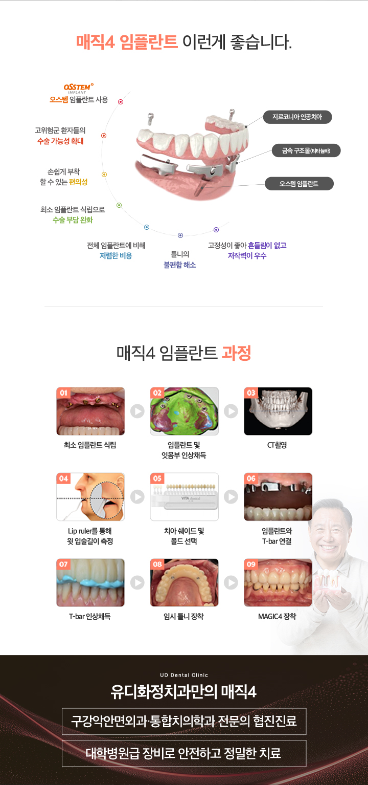 매직4임플란트