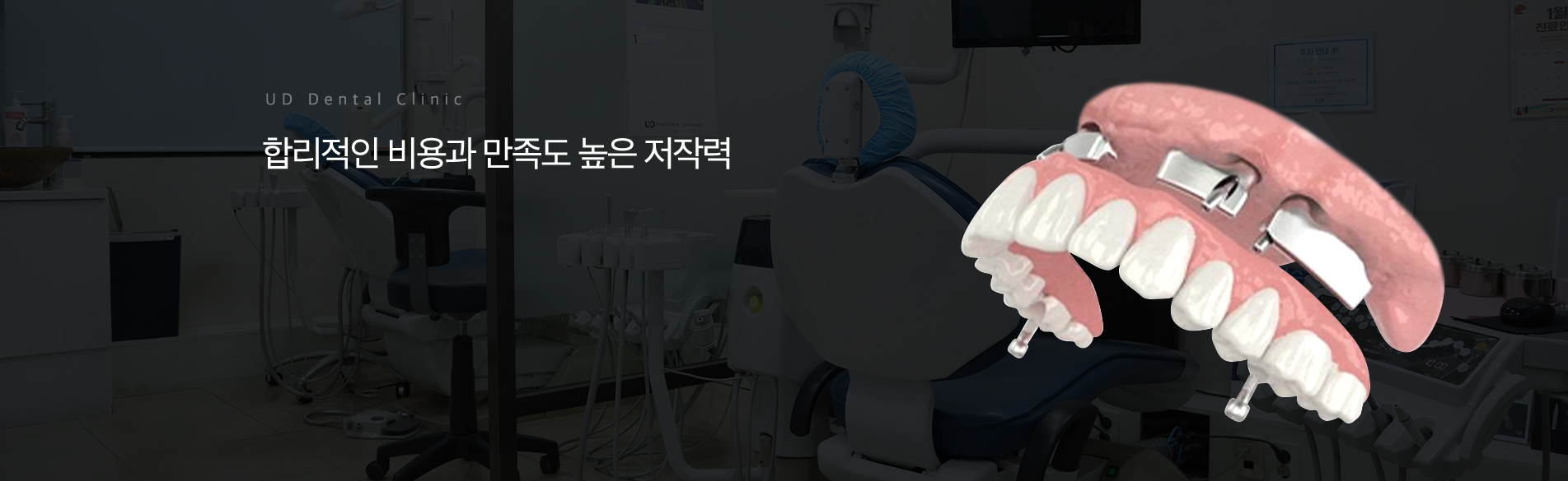 매직임플란트_01