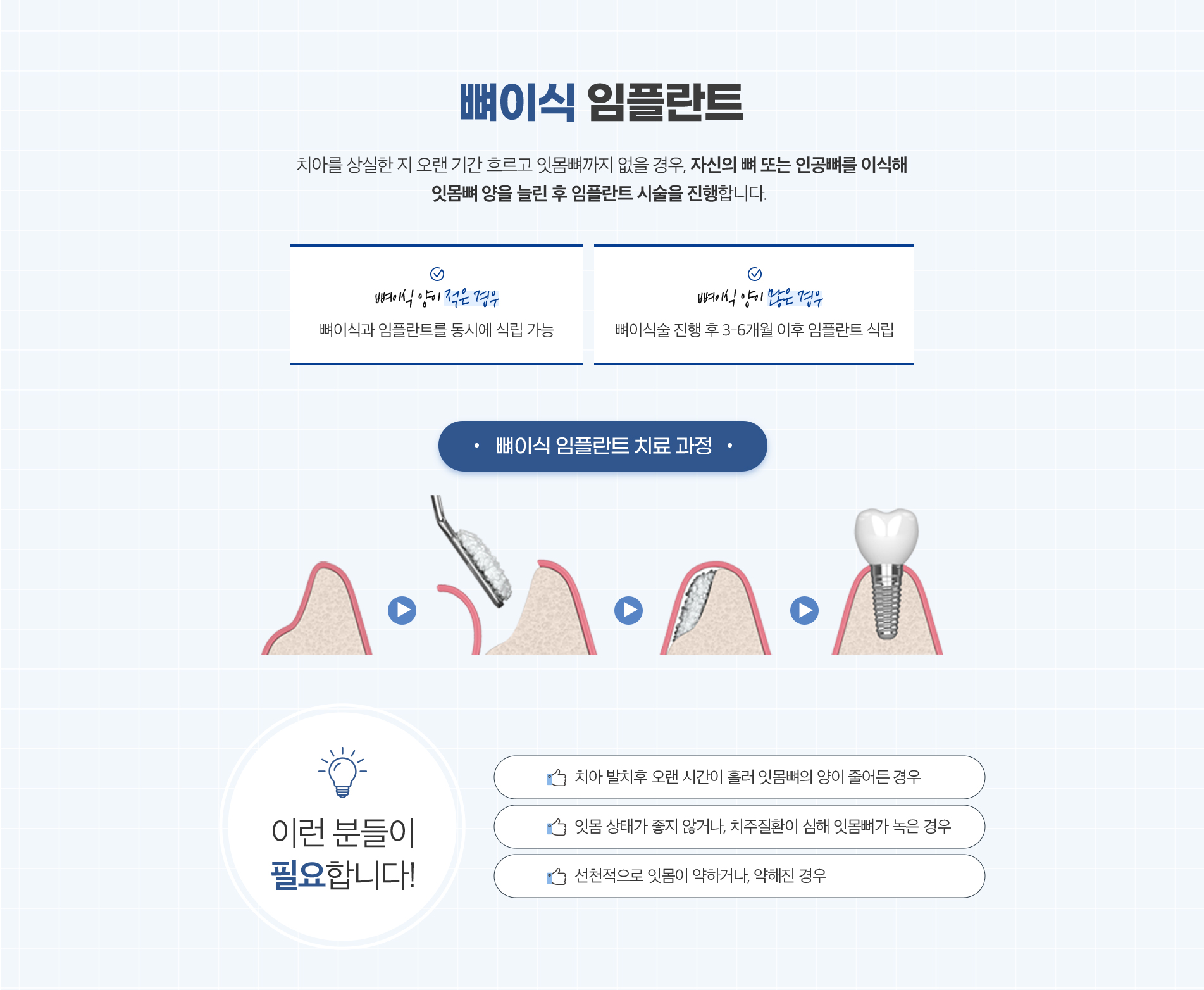 뼈이식임플란트