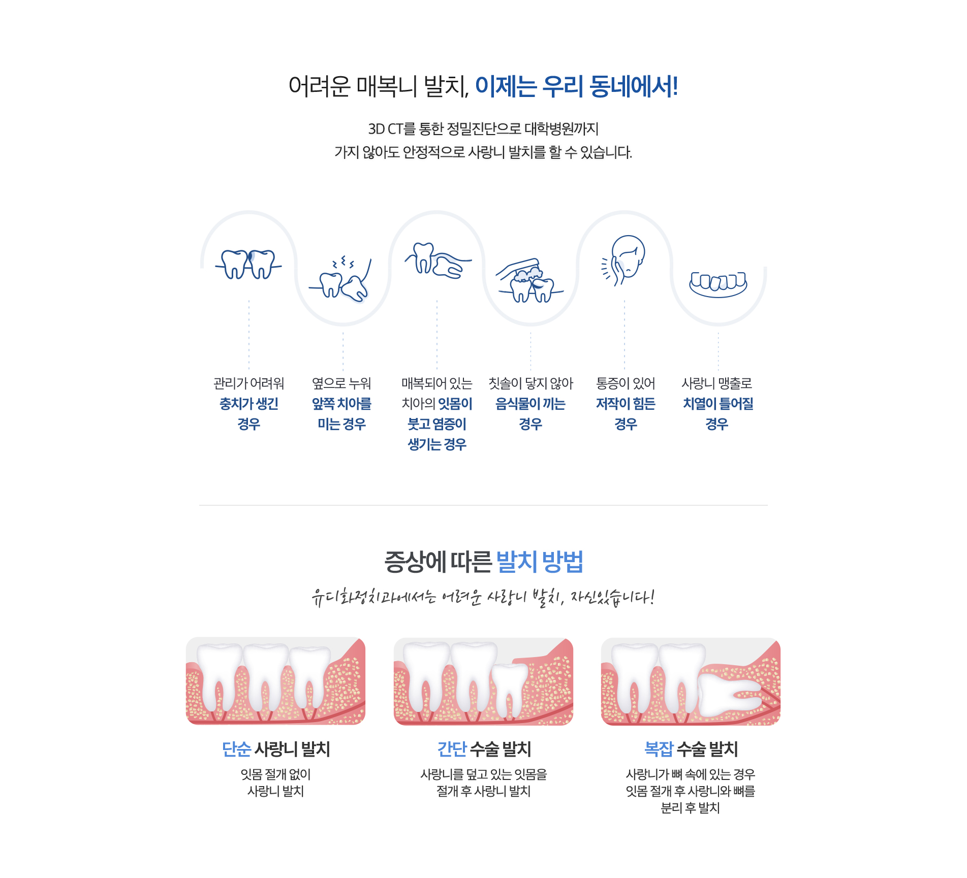 사랑니발치,이제는우리동네에서!