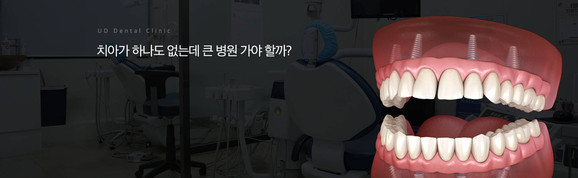 올온엑스-임플란트