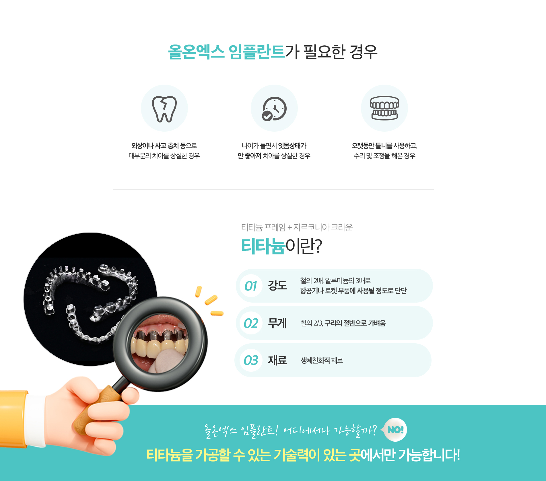 올온엑스임플란트가-필요한경우